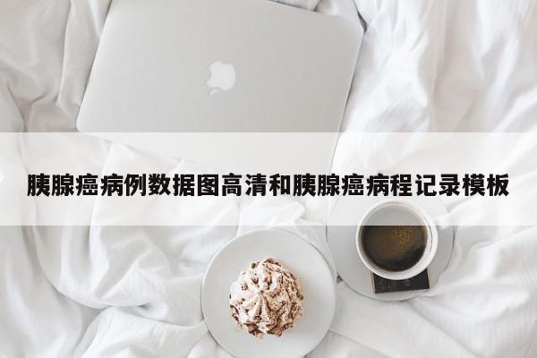胰腺癌病例数据图高清和胰腺癌病程记录模板